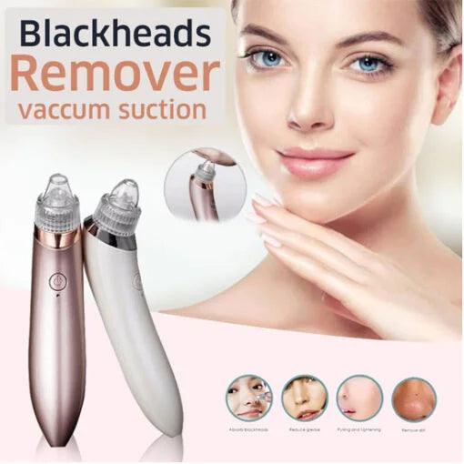 Electric Blackhead Remover – Deep Pore Cleaning Device for Clear Skin